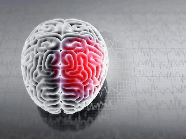 腦卒中是國人頭號死因，溶栓的寶貴時間只有4.5小時！